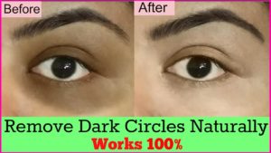 tips to remove dark circles naturally