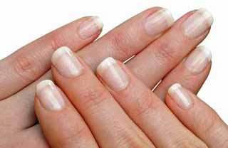 get rid of stained yellow nails