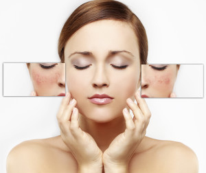 Intense Pulsed Light Therapy For Skin Rejuvenation