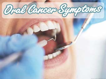 What are the symptoms of mouth cancer