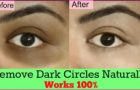 How to remove dark circles permanently