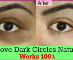 How to remove dark circles permanently